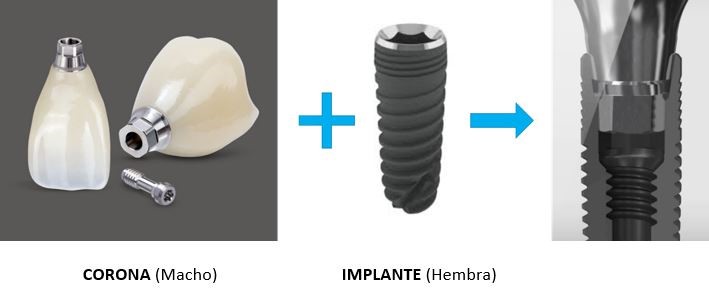 Implante dental