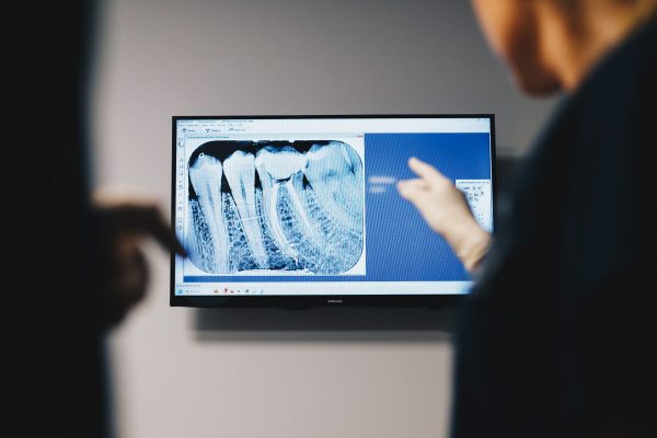 Revisión dental gratuita