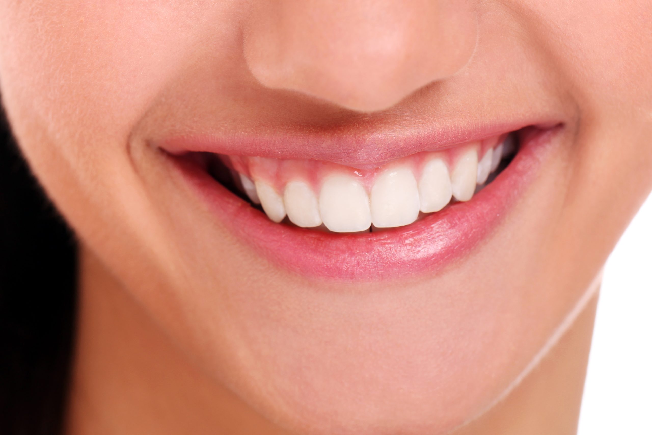 Blanqueamiento dental en Santander