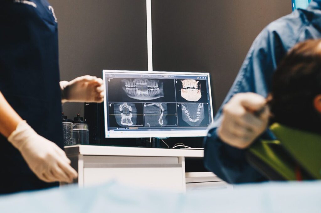 Tipos de implantes dentales