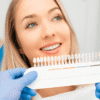 Preguntas frecuentes para carillas dentales