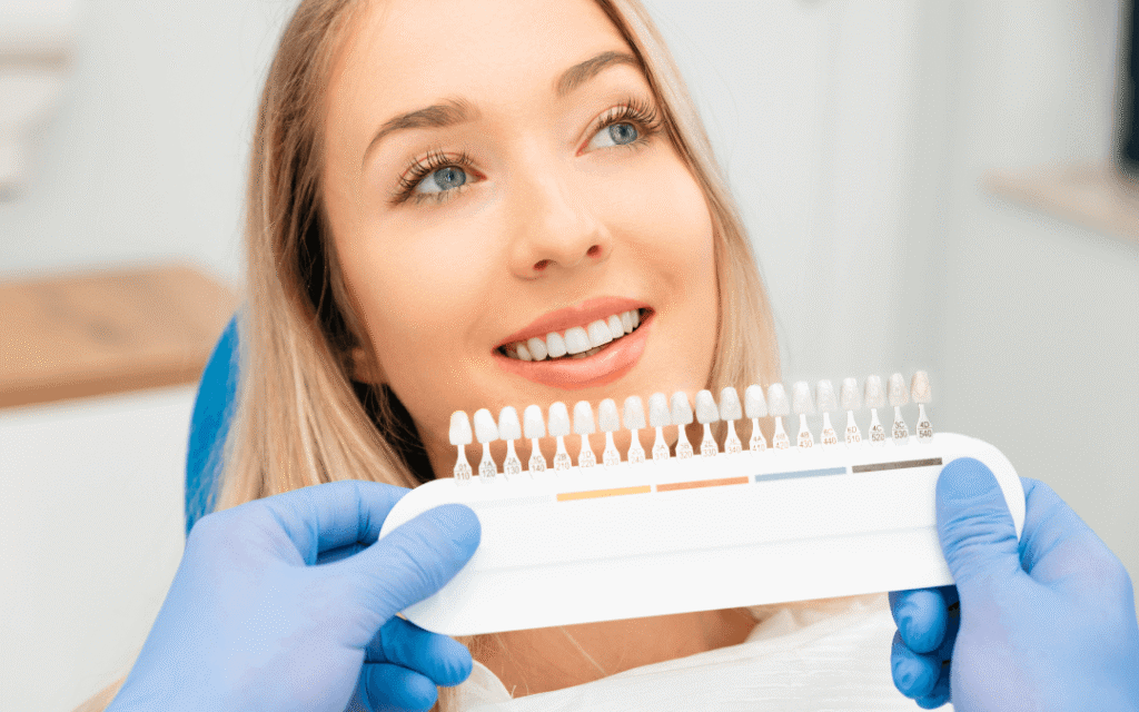 Preguntas frecuentes para carillas dentales