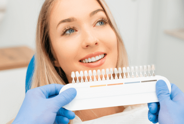 Preguntas frecuentes para carillas dentales