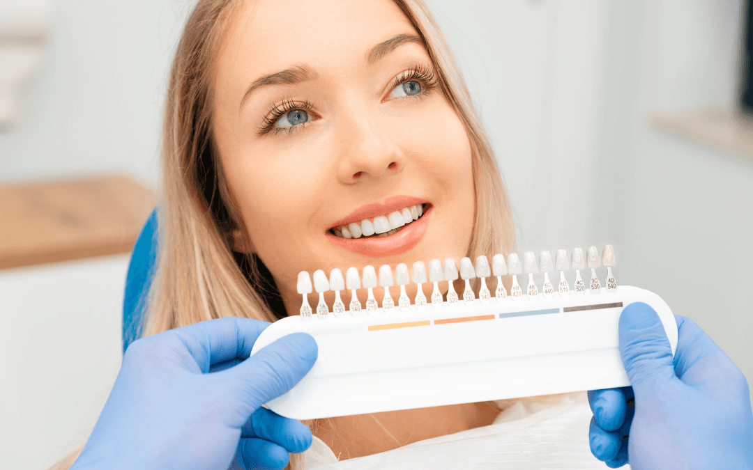 Preguntas frecuentes para carillas dentales